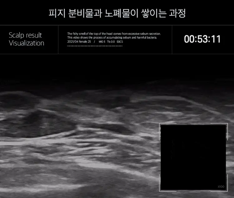 [단독기획] 에퓨놀 바이옴 샴푸 500ml+100ml 기획세트 상세페이지 18
